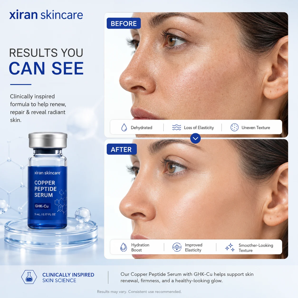 A promotional image showing the before and after skin results of using Xiran Skincare Copper Peptide Serum with visible improvements in hydration, elasticity, and texture.